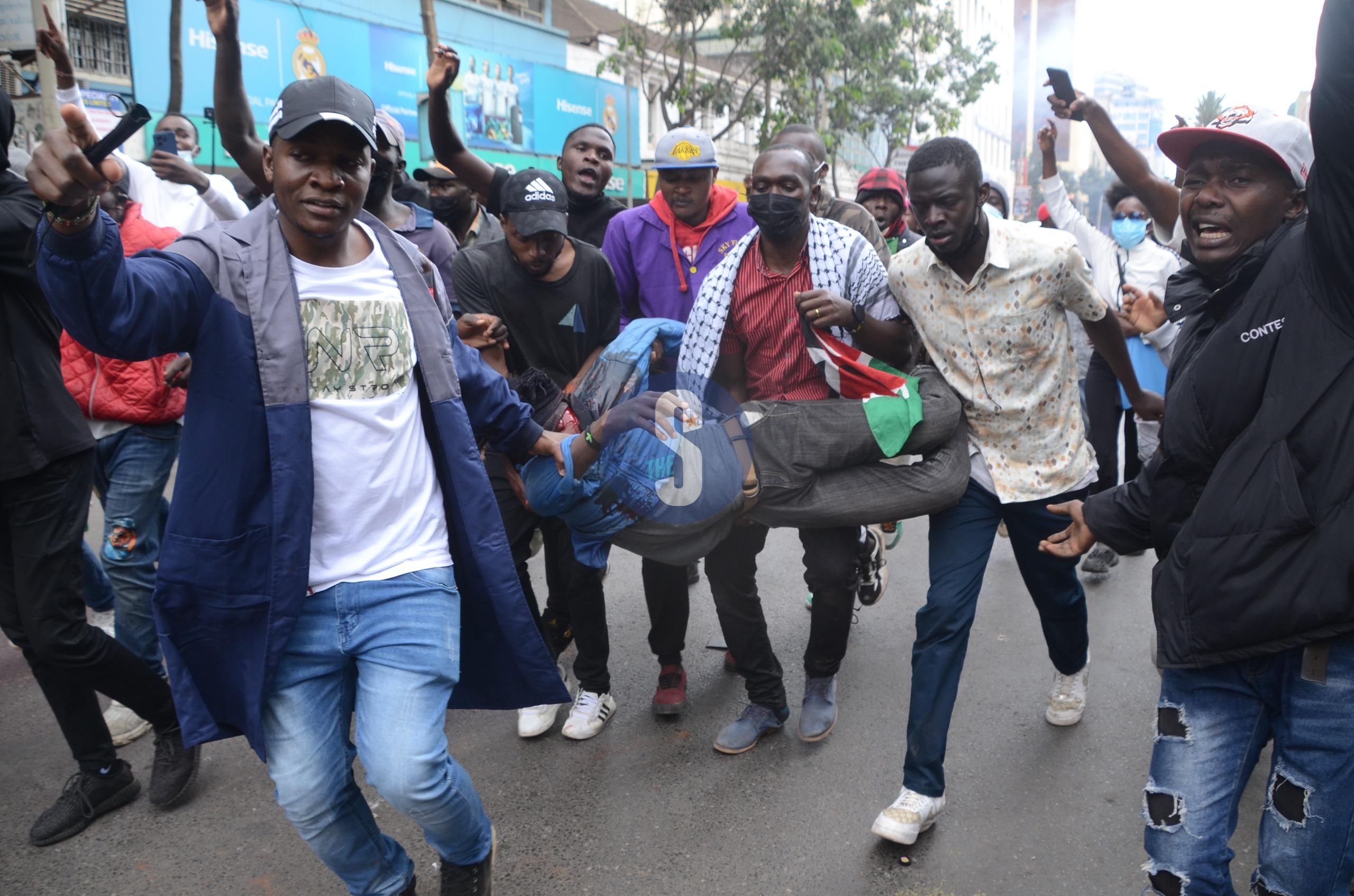 [PHOTOS] Demos: Protester shot by police