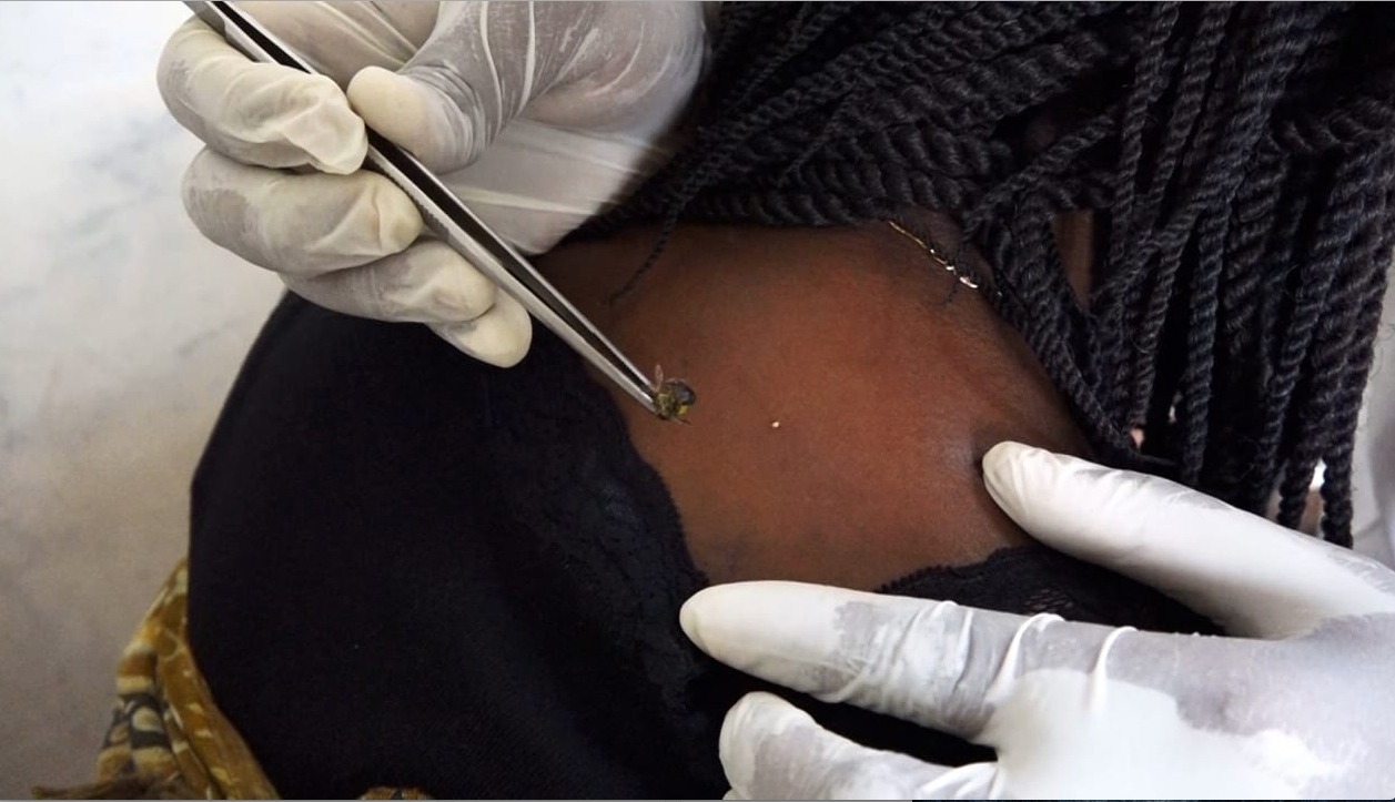 More Kenyans turn to bee venom therapy to manage chronic conditions