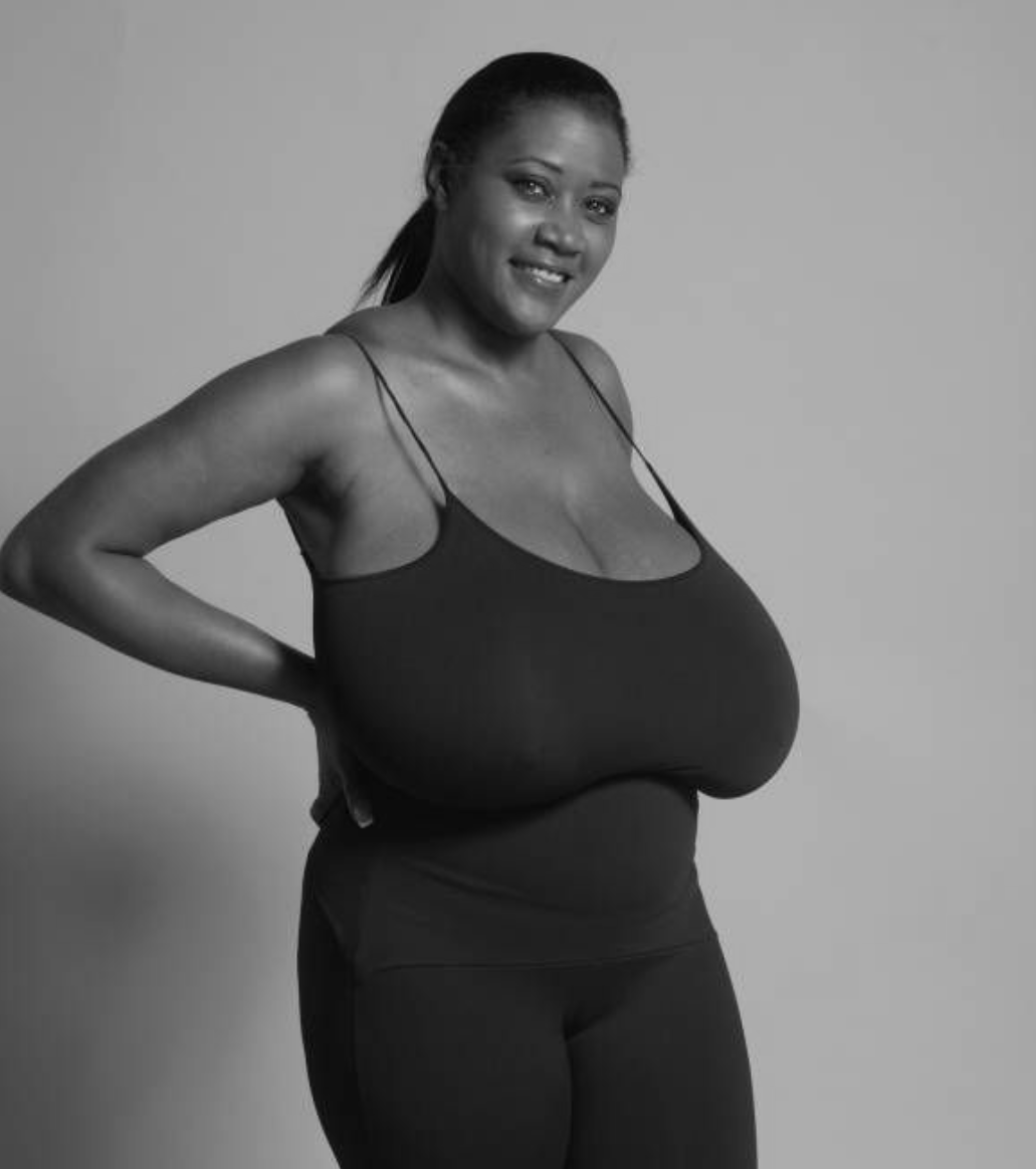 When breasts become a burden
