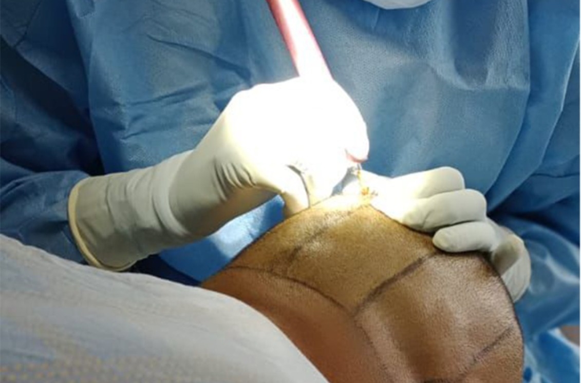 Regenerative medicine; Africa's next great medical frontier