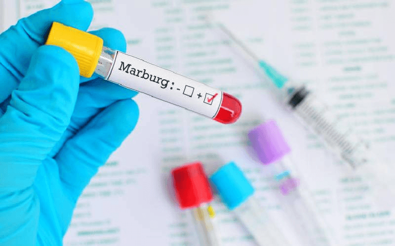 Tanzania confirms Marburg virus outbreak